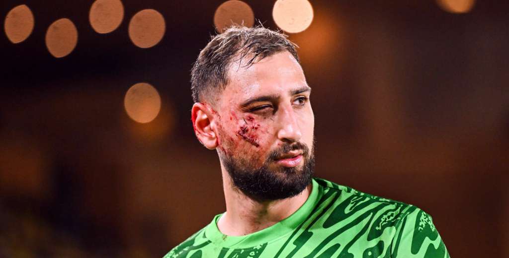 Despu&eacute;s del corte, PSG tomar&iacute;a la decisi&oacute;n m&aacute;s inesperada con Donnarumma