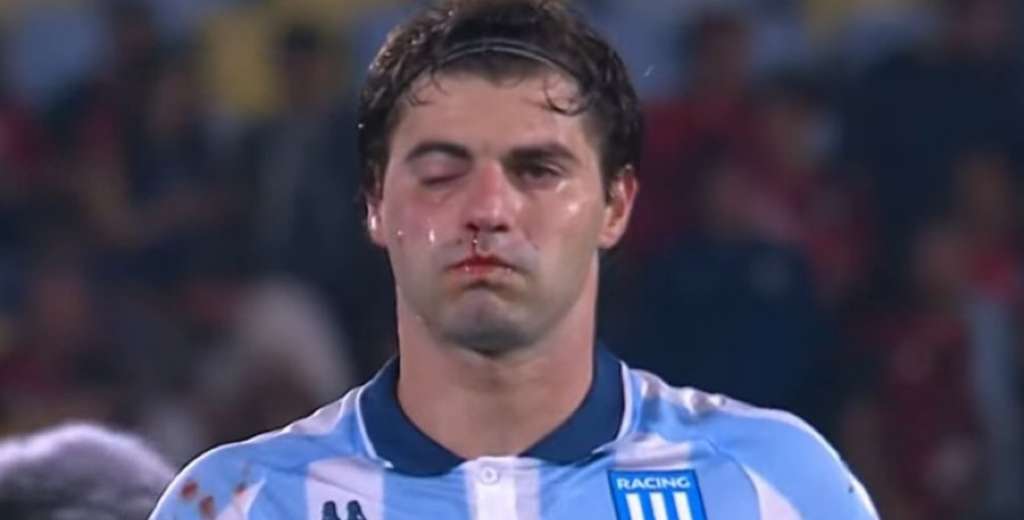 Marcos Rojo enloqueció a los 97: le dio un codazo a Santiago Sosa y lo desfiguró