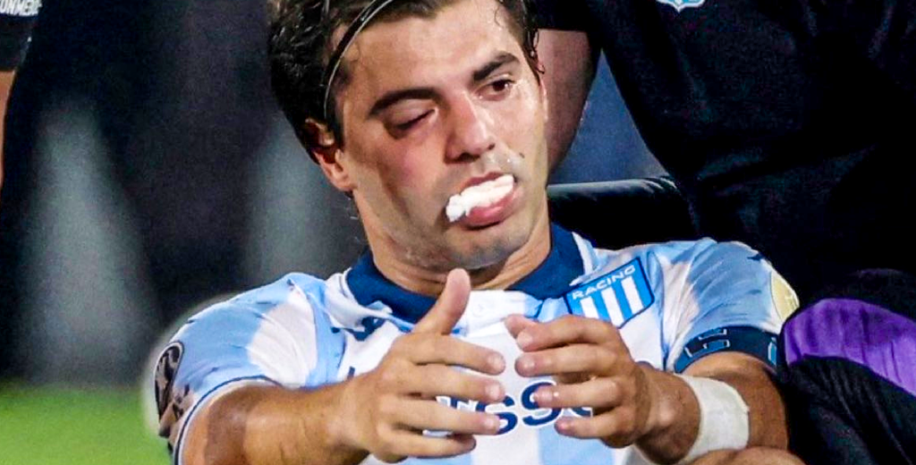 Racing y la peor noticia: el codazo de Rojo a Sosa acaba en el final más duro