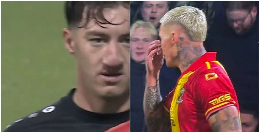 La imagen más lamentable del año: Edvardsen se burló de la nariz de Angelo Stiller