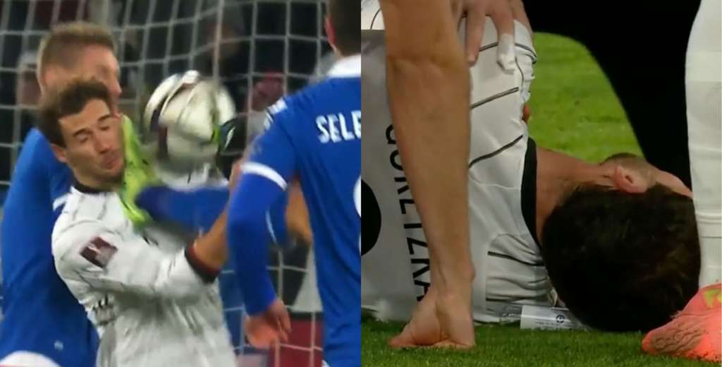 &iexcl;Casi lo mata! La impactante patada en la cara a Goretzka