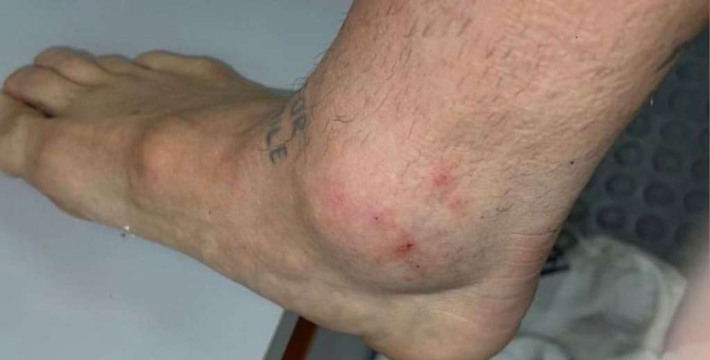 La estrella argentina que termin&oacute; con el tobillo destrozado ante Chile
