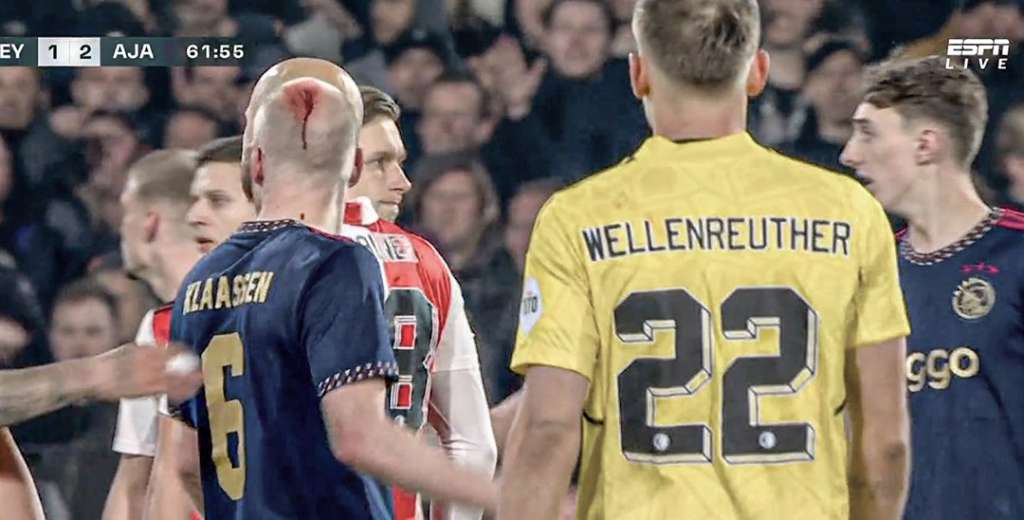Esc&aacute;ndalo y disturbios en Pa&iacute;ses Bajos: Ajax termin&oacute; con un jugador sangrando