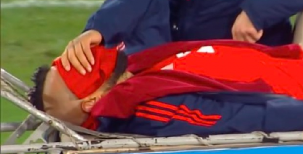 Lo de Arturo Vidal es para aplaudir: jug&oacute; 70 minutos lesionado y se fue en camilla