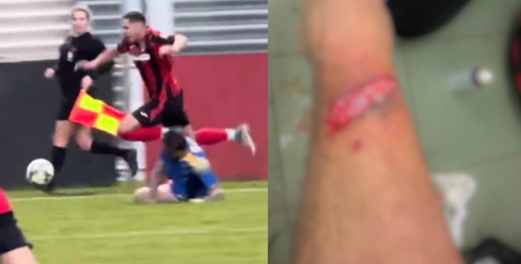 Una escalofriante lesi&oacute;n en el ascenso ingl&eacute;s tuvo una ins&oacute;lita decisi&oacute;n arbitral