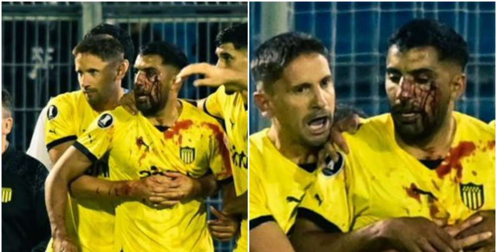 Olivera fue agredido, se desmay&oacute; y Central recibir&iacute;a la peor sanci&oacute;n de todas