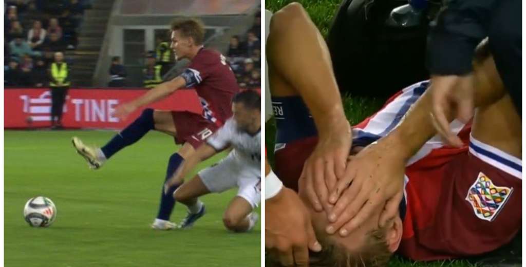 La preocupante frase del entrenador de Noruega tras la brutal lesi&oacute;n de Odegaard